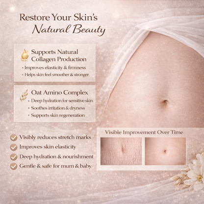 Stretch Marks Cream